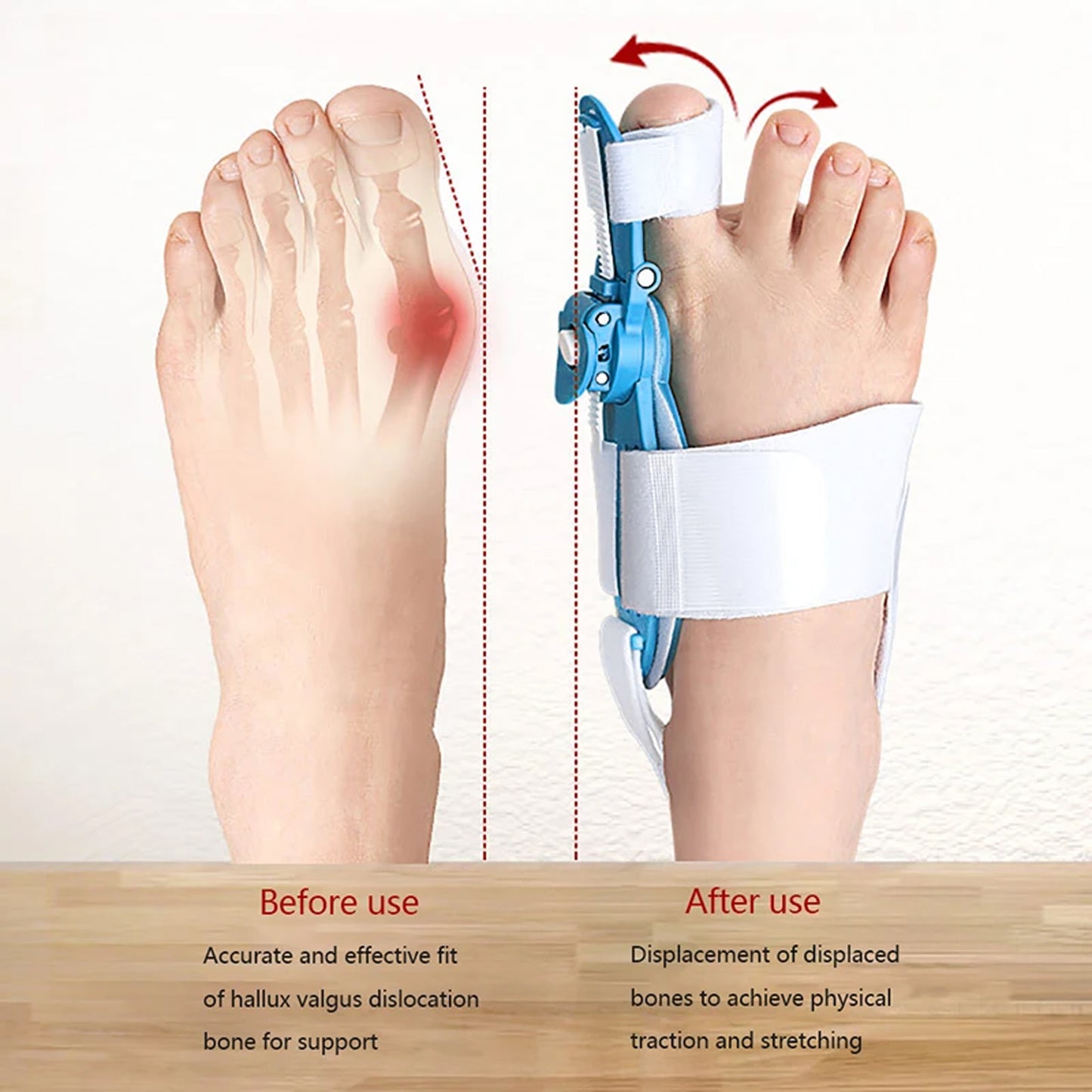 Bunion Support Splint. Valgus And Bunion Valgus Corrector Hallux Valgus Corrector Adjustable Bunion Valgus Protective Cover For Men And Women - LootFaat