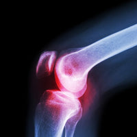 (Xl) Knee Cap For Knee Support - LootFaat