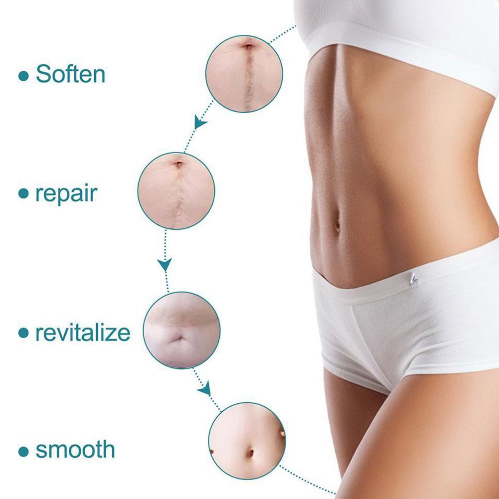 Silicone Scar Tape – Reusable Silicone Gel Sheet for Scar Removal & Repair