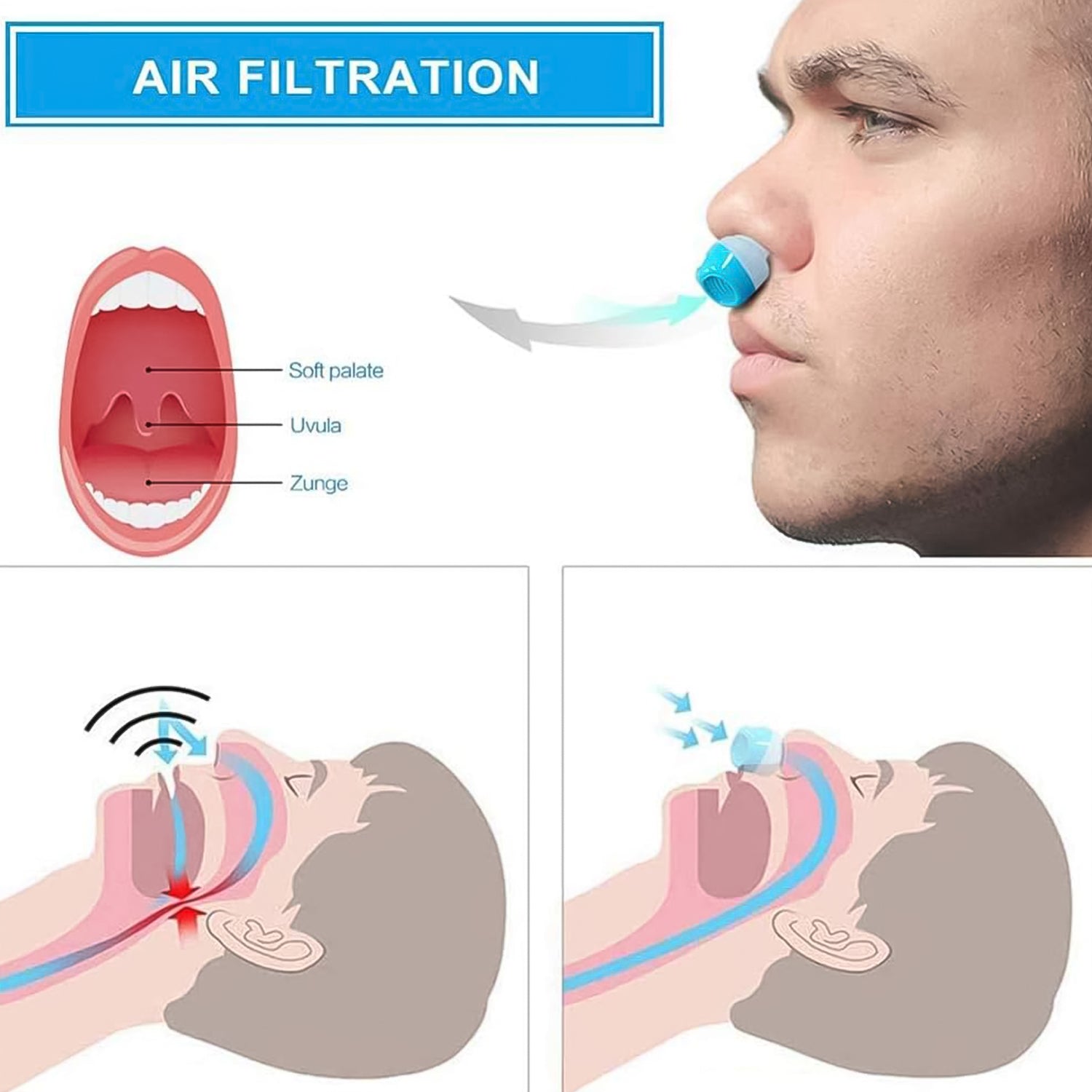 2 In 1 Anti Snoring And Air Purifier Nose Clip Anti Snoring Device (1 Pc  With Plastic Case) - LootFaat