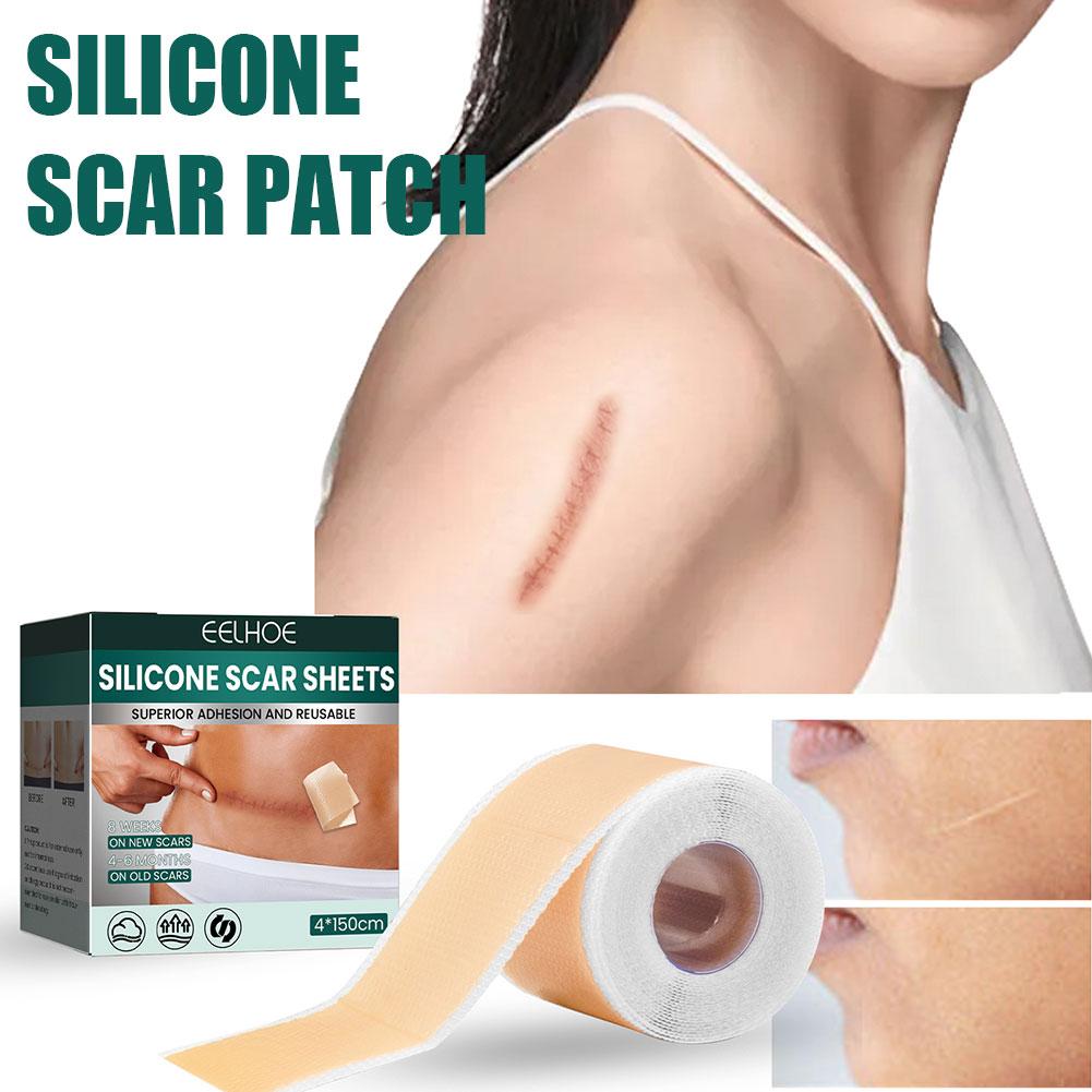 Silicone Scar Tape – Reusable Silicone Gel Sheet for Scar Removal & Repair